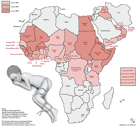 Länder, in denen Weibliche Genitalverstümmelung praktiziert wird